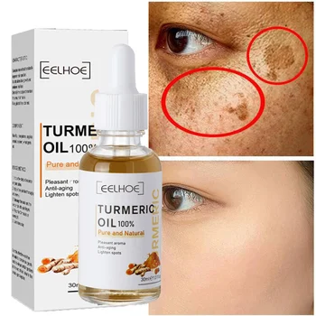 Beljenje Freckle Obraz Serum Kurkuma Temno Spot Remover Pigment Melanin Popravljanje Olje Anti-Aging Polepšajo Vlažilno Kremo Za Nego Kože